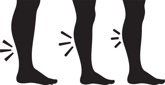 Leg swelling medical symptom circulation problem edema illustration