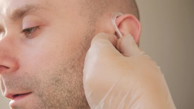 female hands fitting hearing aid on young patient's ear, close-up audiological hearing support, modern sound device, healthcare assistance, professional medical treatment, behind-the-ear technology