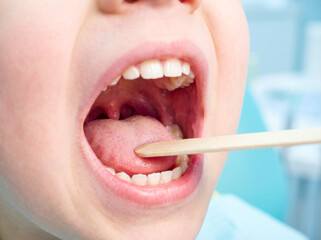 Naklejka premium Child Oral Cavity with Healthy Teeth and Tongue