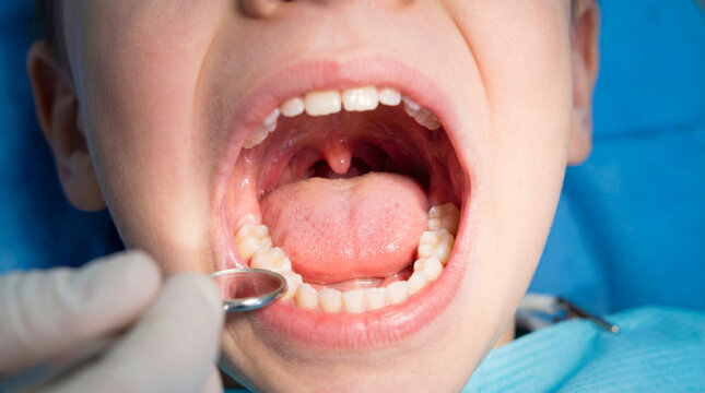 Child Oral Cavity with Healthy Teeth and Tongue