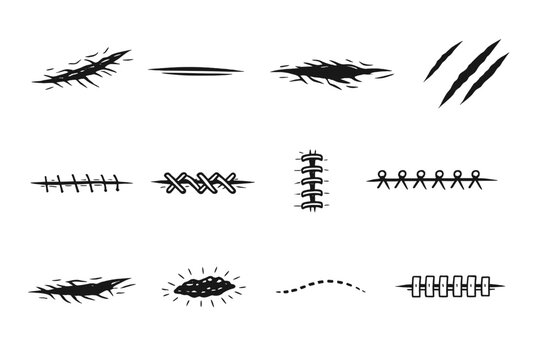 Set of Stylized Monochrome Linear Elements Depicting Various Skin Lacerations, Healing Surgical Stitches, Sutures, and Claw Marks. Hand-Drawn Vector Illustration for Medical or Horror Graphics.
