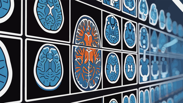 Medical Brain Scans and Diagnostic Imaging