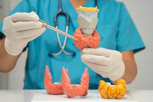 Hyperthyroidism, Overactive Thyroid, Thyroid Lymphoma, Asian doctor with thyroid gland human anatomy model in hospital.