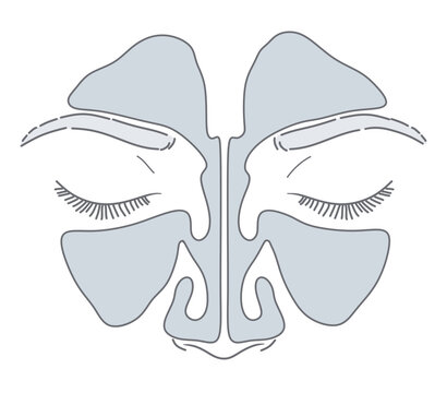 Human paranasal sinuses anatomy vector illustration. Frontal view of the face showing frontal and maxillary sinus cavities in gray and outline styles. ENT Series.