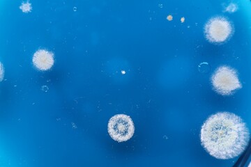 Biochemistry. Petri dish with samples as background, top view