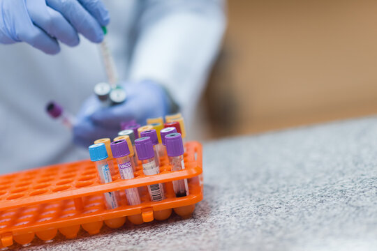 Laboratory technician preparing blood samples and vials in a clinical testing lab