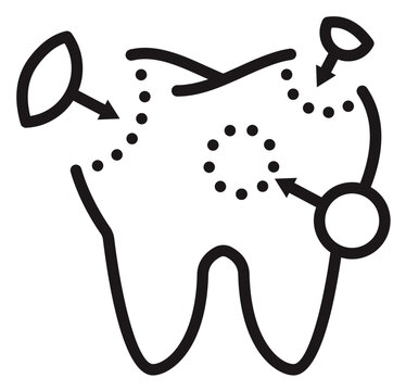 Dental Restoration and Tooth Filling Vector Icon. Minimalist Black Line Art Illustration of a Molar with Dotted Repair Areas and Arrows for Stomatology and Oral Healthcare Concepts.