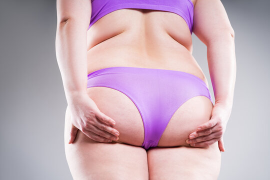 Overweight woman in purple underwear showing back fat folds and cellulite on buttocks, weight loss concept