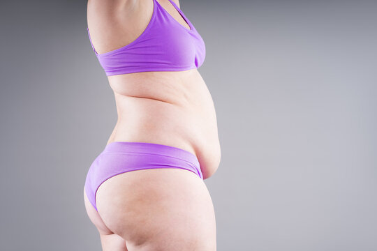 Overweight woman in purple underwear showing back fat folds and cellulite on buttocks, weight loss concept