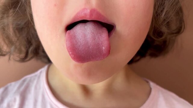 Close up of a child sticking out tongue for inspection. Concept of oral health, hygiene, medical check and speech development
