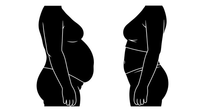 Comparison of pregnancy stages illustrated through body shape changes from side views Vector, illustration