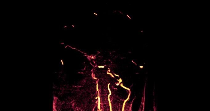 Medical imaging of human brain showing MRA, MRI, and CTA scans with blood vessels and neural anatomy. Ideal for neurobiology research, medical education, and healthcare technology concepts.