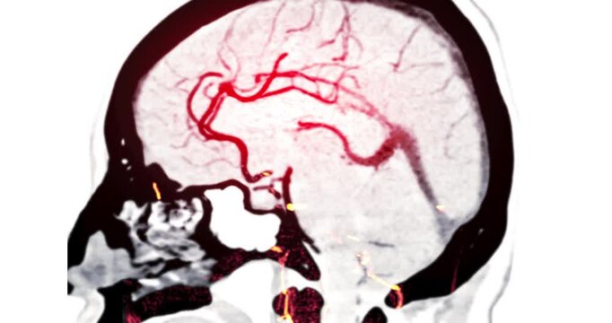 Medical imaging of human brain showing MRA, MRI, and CTA scans with blood vessels and neural anatomy. Ideal for neurobiology research, medical education, and healthcare technology concepts.