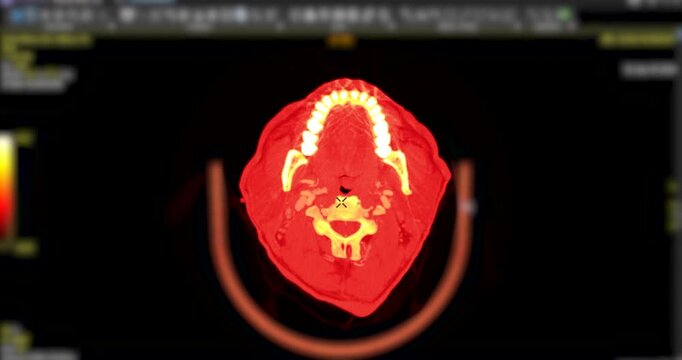 Detailed axial cross-section animation of a human head and neck CT scan. Visualized with an orange and red heatmap highlighting bone structure and cerebral anatomy.