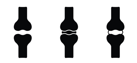 Obraz na płótnie Canvas Structure of the knee joints. Cartoon knee bones. Bones icon set. Anatomy, human knee bone snatomy concept. Broken knee joint with pain. Bone joints. Science design. Human leg.