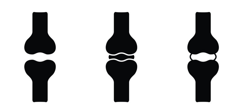 Structure of the knee joints. Cartoon knee bones. Bones icon set. Anatomy, human knee bone snatomy concept. Broken knee joint with pain. Bone joints. Science design.  Human leg.