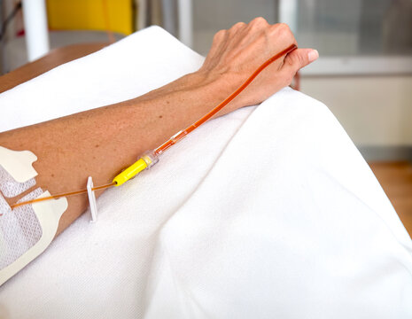 Close Up of IV Iron Infusion Drip Chamber on White Background