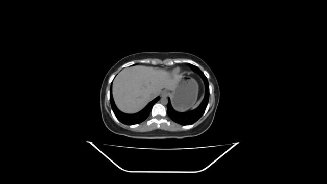 Advanced radiological imaging of the abdominal cavity using computed tomography to evaluate the urinary tract and renal health.