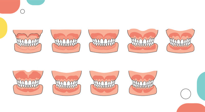 Dental chart displaying various types of malocclusion and tooth alignment issues in human jaws for medical study.
