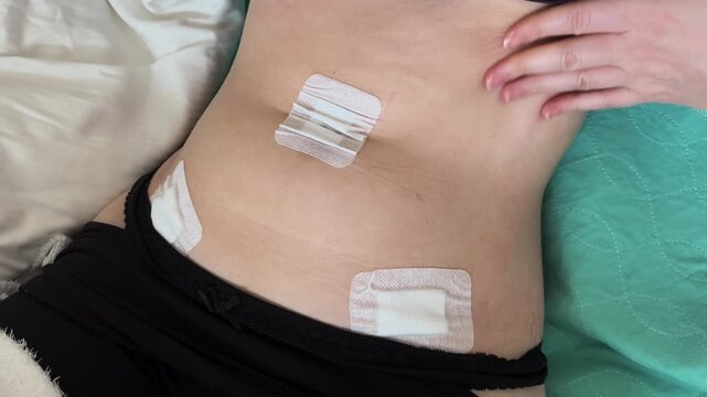 Close-up of abdomen with surgical bandages after operation. Concept for recovery, healing process, and medical care.