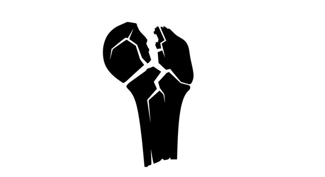 Silhouette of a fractured bone with visible cracks, resembling an X-ray image, on a stark white background