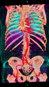 Human torso 3D CT scan skeletal system abdominal aorta