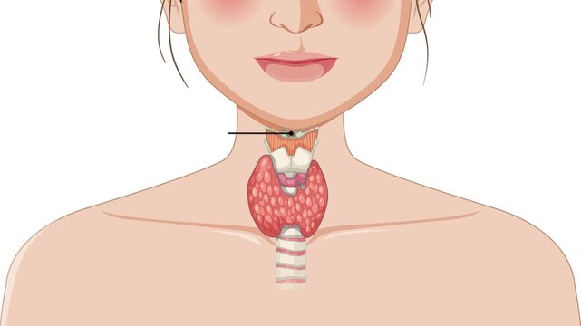 Anatomical diagram showing thyroid gland and trachea with labels in a person's neck.