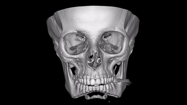 Three dimensional computed tomography medical imaging of human skull for diagnostic radiology dental surgery planning and anatomical education on black background