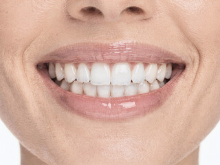 Obraz premium Close up happy woman smile show perfect white teeth, clean oral hygiene