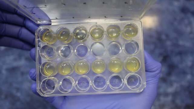A close-up of a scientist opening the lid of an immunoassay plate, revealing wells filled with yellow liquid. An immunoassay plate for titrating bacteriophages.