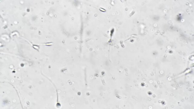 Microscope view human sperm cells motility visible, high magnification showing swimming tails and heads, phase contrast background with light debris, stained semen sample on glass slide, technician