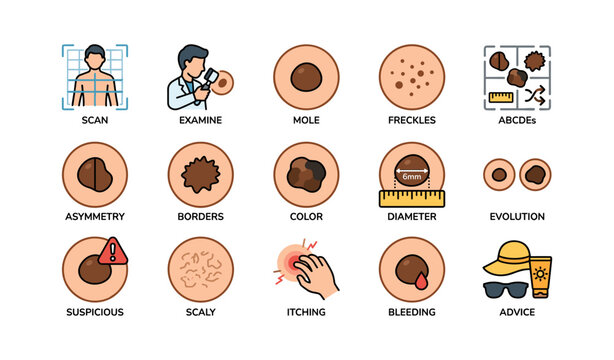 Skin cancer awareness: identifying moles and symptoms with male doctor guidance
