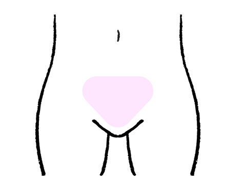 脱毛 Vライン 手書き