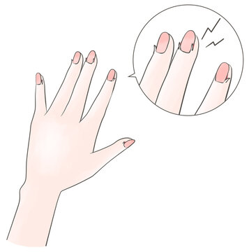 傷んだ手のイラスト　ささくれ