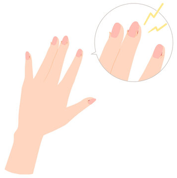 傷んだ手のイラスト　ささくれ