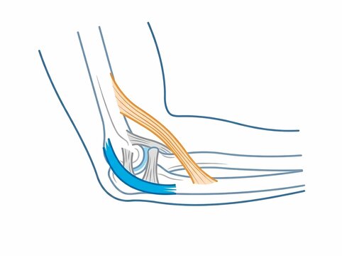 A clean medical illustration of the elbow joint showing ligaments, tendons, and UCL reconstruction anatomy, commonly associated with Tommy John surgery in sports medicine.