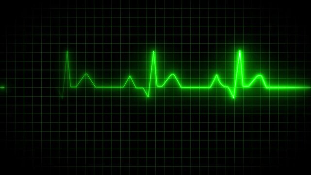 ECG monitor beating heart with a neon electrocardiogram overlay, featuring dynamic HUD elements and a gradient background.Abstract neon heartbeat signal icon animation black background .