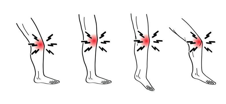 Knee injury. Structure of the knee joints. Human leg. Person with a red knee. Painful, injury, ache, health problems. Knee joint pain, arthritis and tendon problems, health care.