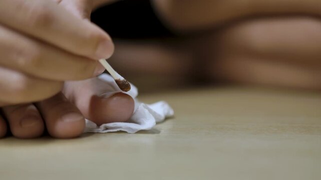 Close-up of a child toe being treated with povidone iodine using a cotton swab. The image highlights antiseptic application, minor wound care, and hygiene in a home setting.