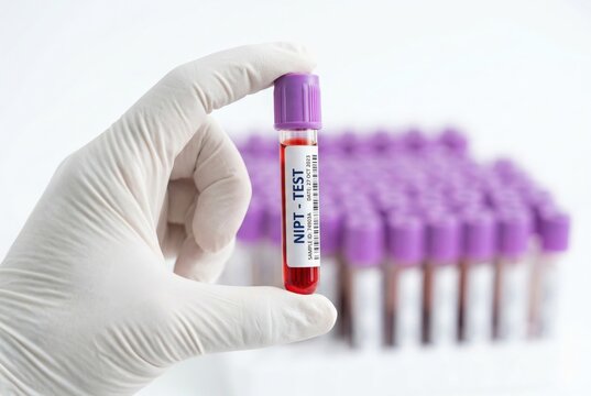 Gloved hand holding blood sample tube for NIPT test in a medical laboratory