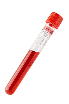 test tube with donor blood on white background. flask of blood for a cholesterol and infection test.medical research and development.