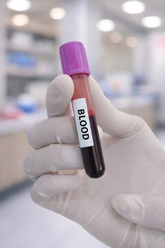 Blood Sample Tube in Hand with Blurred Laboratory Background, EDTA, antikoagulan, purple, vacum sample tube, hematology, specimen. Concept of medical testing, healthcare, laboratory analysis