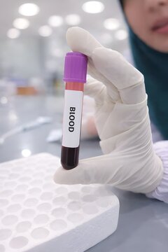 Blood Sample Tube in Hand with Blurred Laboratory Background, EDTA, antikoagulan, purple, vacum sample tube, hematology, specimen. Concept of medical testing, healthcare, laboratory analysis