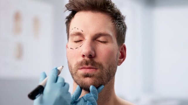 Plastic Surgeon Carefully Marks Male Patient's Face Before Cosmetic