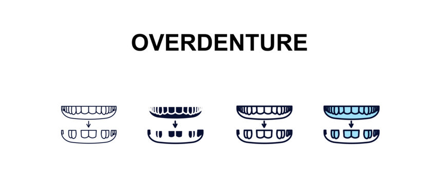 overdenture multi-style outline icon set - dentist concept. Thin line, regular, filled, colored overdenture icon