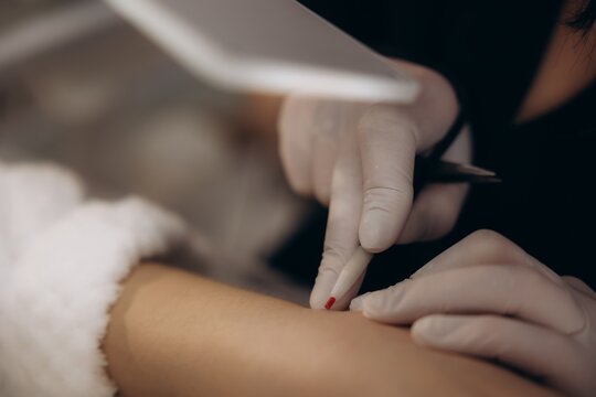 Dermatologist performing skin biopsy procedure on patient arm