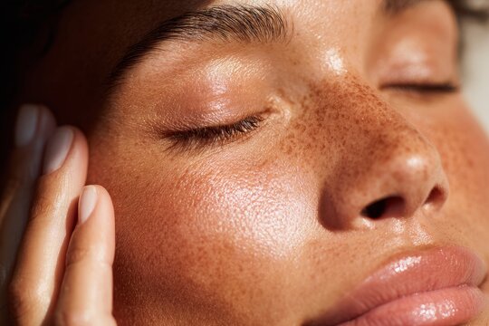 Freckled face glowing skin after sun protection routine