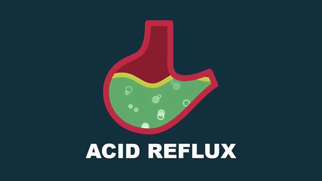Medical illustration of a human stomach with bubbling green acid representing acid reflux and heartburn
