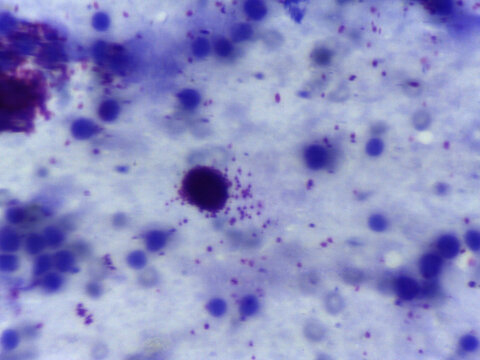 Leishmania Parasite Infected Blood Smear Microscope Giemsa S
