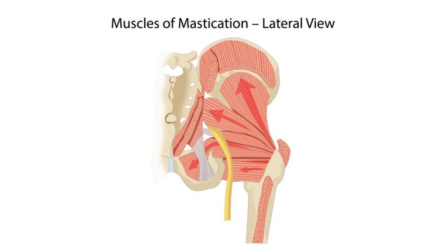 Muscles of Mastication &ndash; Lateral View
major muscles of mastication including masseter, temporalis, and pterygoids.